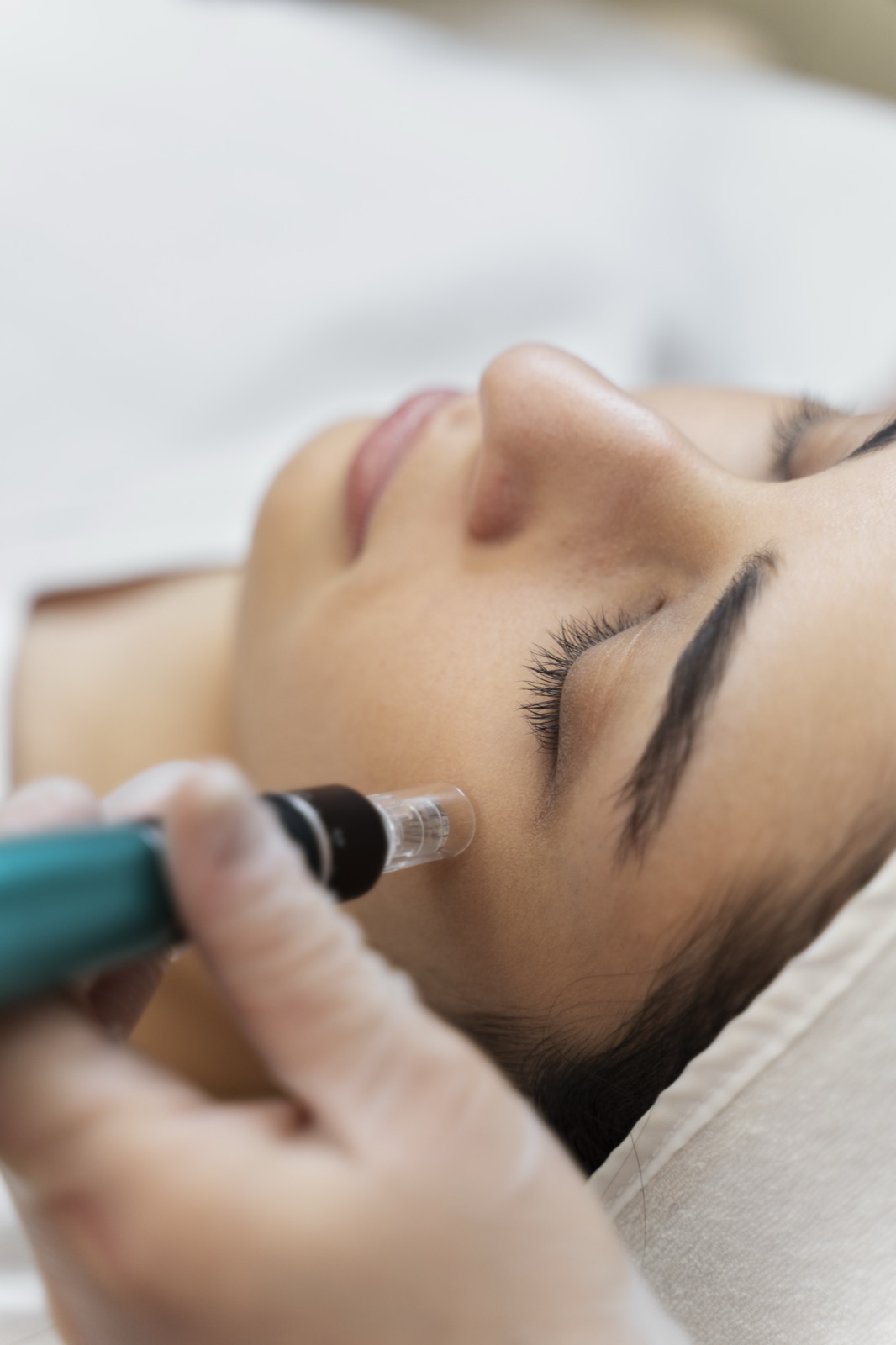 Mésothérapie & skinboosters — Nuevaderm Paris